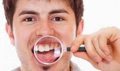 Những vấn đề răng miệng thường gặp và giải pháp từ chuyên gia